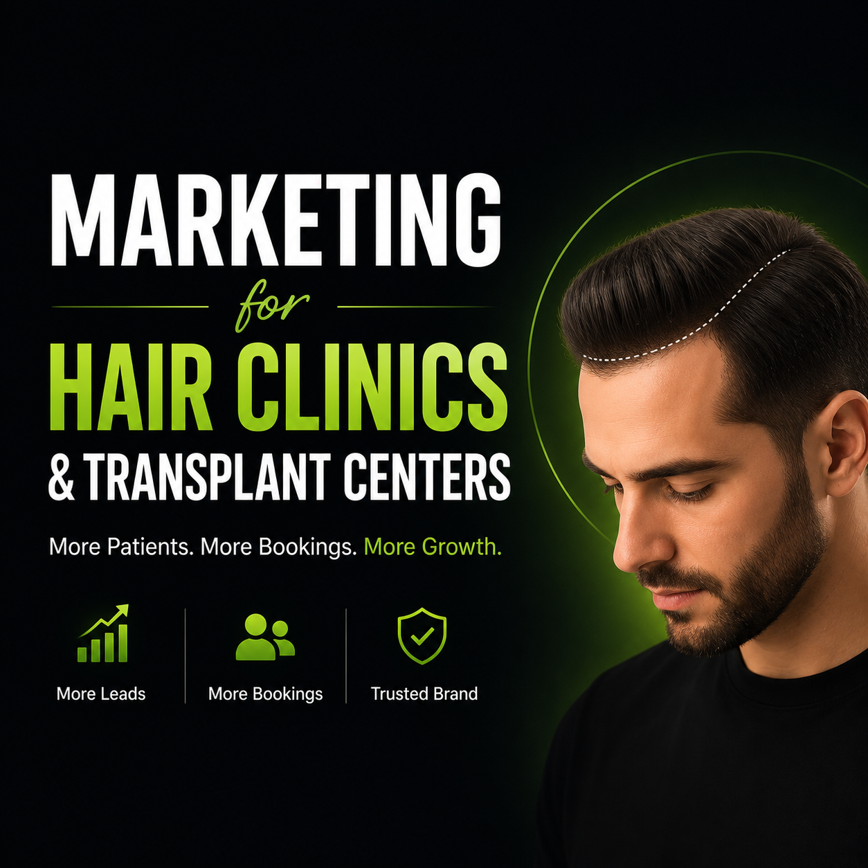 Marketing for Hair Clinics & Transplant Centers